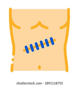 vector de icono de heridas quirúrgicas cosidas. signo de herida quirúrgica cosida. ilustración de símbolo de color