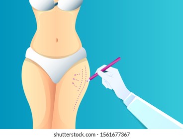 stock vector of hand drawing dotted lines on woman buttocks. describe of plastic surgery, surgical cosmetic procedure. for advertising and medical publications.