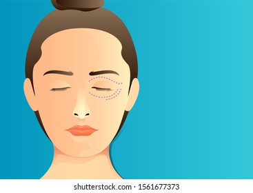 stock vector of woman with dotted line on eyelid. front view women chest. describe of plastic surgery, surgical cosmetic procedure. for advertising and medical publications.