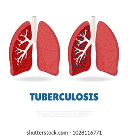 StockVector Illustration on the theme World Tuberculosis Day