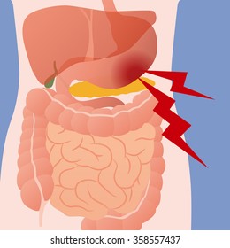 stomach ache and human digestive organs, vector illustration