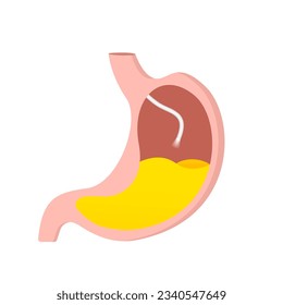 Stomach ache pain icon, endoscope gastroscopy examination, digestive gastric colonoscopy technology logo flat 3d cartoon graphic, medical health care clinic image, abdomen clipart. Vector illustration