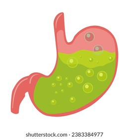 Stomach acid, or gastric acid, is a watery, colorless fluid that's produced by your stomach's lining. It's highly acidic and helps break down food for easier digestion.