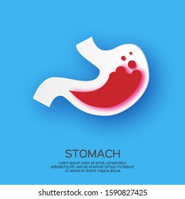 Stomach Acid Reflux, Gastric Acid In Paper Cut Style. Water Fluid. Indigestion And Stomach Pain Problems. Human Organ Symbol On Blue.