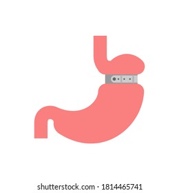 Stomach banding isolated. Adjustable Gastric Band. vector illustration svg