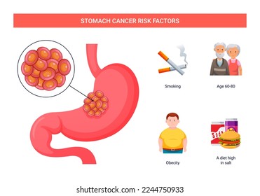 Stomach cancer risk factors infographic