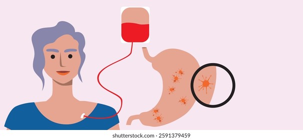 Stomach cancer and site stasis, flat vector stock illustration with cancer patient, oncology concept, copy space template for overlay and design