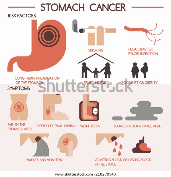 Stomach Cancer Vector Eps 10 Stock Vector (Royalty Free) 218298343