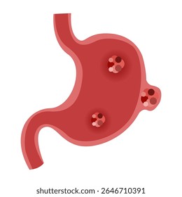 Concepto de enfermedad estomacal. Ilustración vectorial