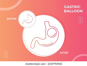 Stomach Endoscopy Gastric Balloon Inside a Stomach weight loss surgery vector illustration obesity 
 svg