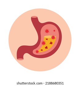 The stomach is filled with bacteria and ulcers.