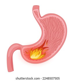 Stomach fire. Vector illustration, cartoon style, white background
