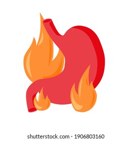 Estómago. Órganos internos humanos. Anatomía del sistema digestivo. Quemaduras de corazón. Enfermedad por reflujo gastroesofágico. Estómago GERD ardor esófago. Ilustración del vector 
