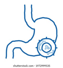 Stomach Infection sketch icon vector. Hand drawn blue doodle line art Stomach Infection sign. isolated symbol illustration