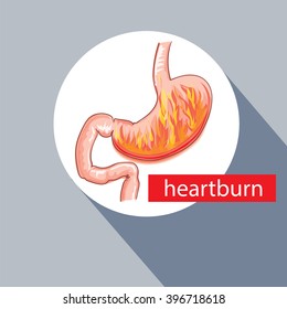 Stomach info graphic design. Discomfort in digestive tract.   Stomach ulcer. Heartburn.