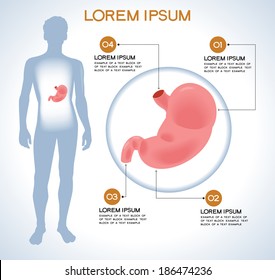Estômago. Infográficos médicos modernos. Órgãos internos em um corpo humano. Anatomia das pessoas