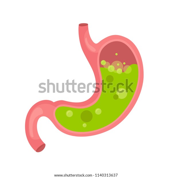 Stomach Nausea Diseases Stomach Vomiting Flat Stock Vector (Royalty