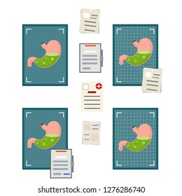 Stomach on the x-ray image. Internal human organ. Providing medical care. Digestive problems. The set of elements of the hospital. Paper file document diagnosis. Cartoon flat illustration