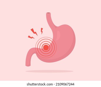 Stomach Pain. Gastritis, Indigestion, Heartburn. Vector Illustration Of Human Internal Organ.