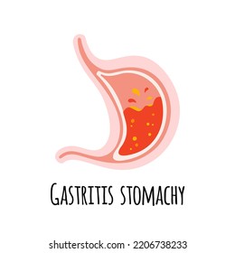 The stomach of a person with gastritis. Gastroenterology. Vector illustration in a flat 