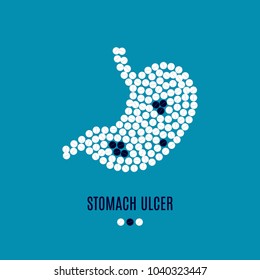 Stomach ulcer awareness vector poster with stomach made of white and black pills on blue background. Chronic erosive inflammation. Medical solidarity concept for clinics. Human body organ anatomy icon