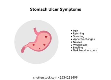 Sintomas de úlcera do estômago. Informações médicas e diagrama