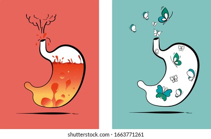 Stomach vector illustration  Concept two different health conditions  The first shows heartburn   volcano fire  The second shows comfort in the form flying butterflies  Medical theme 