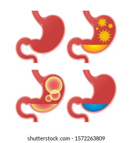 Stomach vector illustration. Human stomach anatomy in different situations: empty, cramps, bloating, winds, flatulence, pain. Realistic stomach icon. Part of set. 