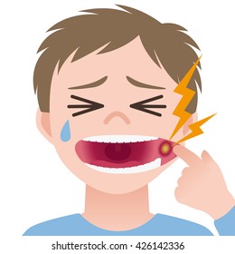 stomatitis, mouth ulcer, inflammation of the oral mucosa, image illustration