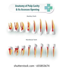 Stomatological anatomical atlas. Table Pulp Cavities
And its opening access. Image of human teeth for dental purposes