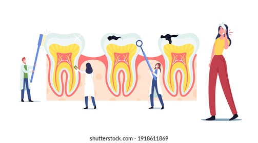 Stomatology, Dentistry Concept. Tiny Dentists Characters Cleaning, Treating Huge Unhealthy Tooth with Caries Cavity. Doctors Work Together Brushing, Clean Plaque. Cartoon People Vector Illustration