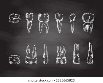 Estomatología dibujada a mano sobre fondo de pizarra. Tratamiento de dolor de dientes. Esbozo de dientes. Diferentes tipos de dientes humanos. Grasando colmillos y colmillos.