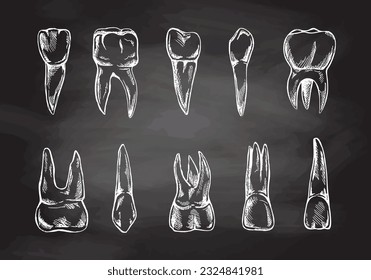 Equipo de estomatología dibujado a mano. Tratamiento de dolor de dientes. Esbozo de dientes.  Diferentes tipos de dientes humanos.  Colmillos y colmillos grabados aislados en el fondo de la pizarra.