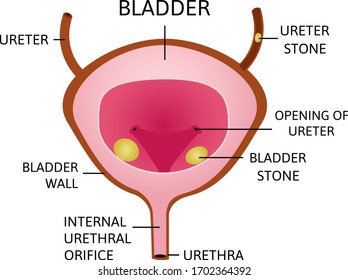 Bladder Stones Images Stock Photos Vectors Shutterstock