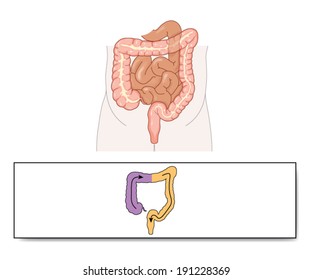 Stool quality of various colostomies