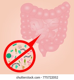 Stop Bacterial overgrowth in small  intestine sign vector illustration
