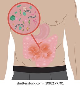 Stop  infection overgrowth in  intestine vector illustration 