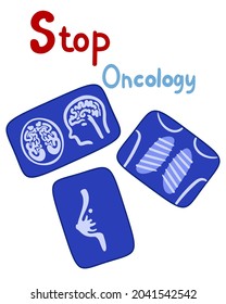 Stop oncology. X-rays of the chest, and brain.