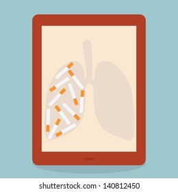 Stop Smoking