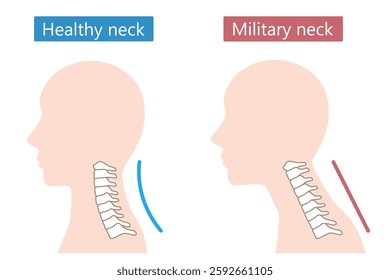 straight neck syndrome and healthy neck neutral human head. Health care concept