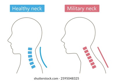 straight neck syndrome and healthy neck neutral human head. Health care concept