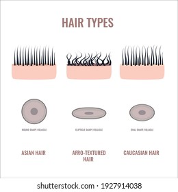 Straight, wavy and curly hair types classification set. Skin and follicles cross-section diagram. Human hair growth style chart. Round, oval, elliptical shapes of hair fiber. Vector illustration.