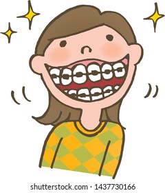 Straightening of irregular teeth