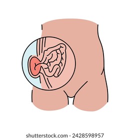 Strangulated hernia line icon. Vector isolated element. Editable stroke.