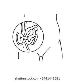 Strangulated hernia line icon. Vector isolated element. Editable stroke.