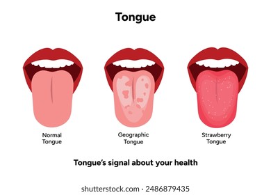 Strawberry tongue, geographic and normal tongue