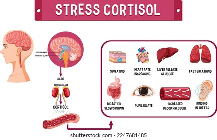 Kortisol-System Stressform, Illustration