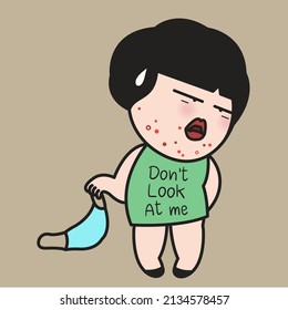 A Stress Young Woman Takes Off Her Protective Mask And Shows Pimples On Her Chin. Concept Of Mask, Acne And Skin Irritation Card Character Illustration