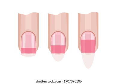 Stress zone of the fingernail. Nail length. Illustration for the manicure guide. Hand nail care .Vector illustration