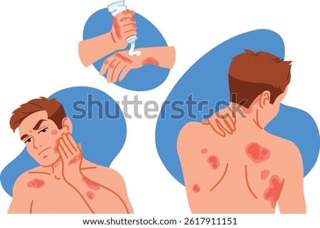 Stressed man with allergic itching, skin inflammation, redness and irritation. Upset guy suffer from itchiness and redness. Atopic dermatitis, eczema, psoriasis, dry skin. Skin diseases set.